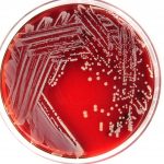 Virulence of S. lugdunensis bacterium in paediatric populations highlighted