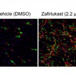 Drug discovery method finds natural metabolite that changes ‘bad’ fat to ‘good’