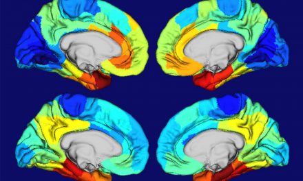 Clues to Alzheimer’s targeting of certain areas of the brain