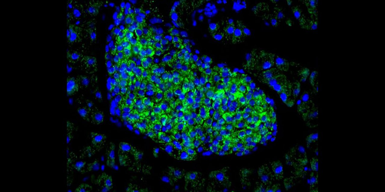 Gene allows beta cells to ‘communicate’ release of insulin