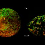 Breakthrough in cancer biopsy identification